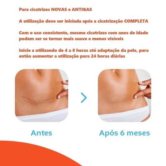 Curativo de Silicone para Cicatrização Cremer Advanced com 4 Unidades