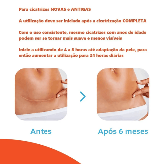 Kit com 5 Caixas de Curativo de Silicone para Cicatrização Cremer Advanced com 4 Unidades